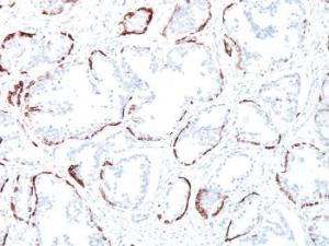 Anti-Keratin 76 antibody