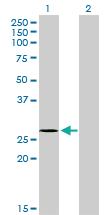 Anti-NDUFS3 Mouse Monoclonal Antibody [clone: 1D6]