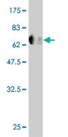 Anti-FLI1 Mouse Monoclonal Antibody [clone: 2F3]