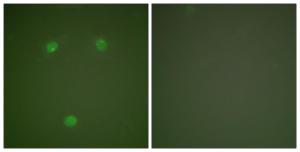 Immunofluorescence analysis of COS7 cells using Anti-GADD153 Antibody. The right hand panel represents a negative control, where the Antibody was pre-incubated with the immunising peptide