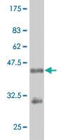 Anti-RUNX2 Mouse Monoclonal Antibody [clone: 4B4]