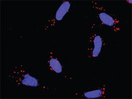 Anti-PTK2 + PIAS1 Antibody Pair