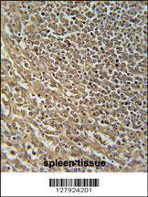 Anti-RASAL3 Rabbit Polyclonal Antibody (Biotin)