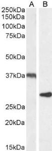 Anti-UCP2 antibody