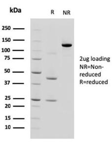 SDS-PAGE analysis of Anti-LI Cadherin Antibody [CDH17/2618] under non-reduced and reduced conditions; showing intact IgG and intact heavy and light chains, respectively. SDS-PAGE analysis confirms the integrity and purity of the antibody.