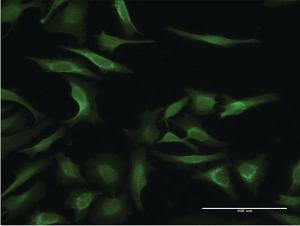 Anti-MAGEA3 Mouse Monoclonal Antibody [clone: 4D9]