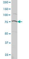 Anti-PRPF3 Mouse Monoclonal Antibody [clone: 3H6]