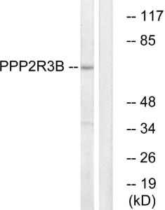 Western blot analysis of lysates from K562 cells using Anti-PPP2R3B Antibody. The right hand lane represents a negative control, where the antibody is blocked by the immunising peptide