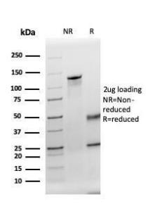 SDS-PAGE analysis of Anti-Thyroid Peroxidase Antibody [TPO/3695] under non-reduced and reduced conditions; showing intact IgG and intact heavy and light chains, respectively SDS-PAGE analysis confirms the integrity and purity of the antibody