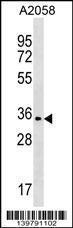 Anti-OR2T35 Rabbit Polyclonal Antibody (HRP (Horseradish Peroxidase))