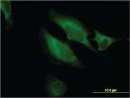 Anti-RAB9B Mouse Monoclonal Antibody [clone: 3C9]