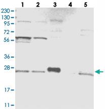 Anti-HDDC2 Rabbit Polyclonal Antibody