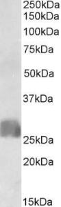 Anti-CREB3L2 Antibody (A82740) (1µg/ml) staining of Human Placenta lysate (35µg protein in RIPA buffer). Primary incubation was 1 hour. Detected by chemiluminescence.