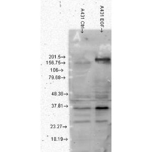 Western blot analysis of human A431 cell lysates showing detection of Phosphotyrosine protein using Anti-Phosphotyrosine Antibody [G104] (A304807) at 1:1,000 for 2 hours at room temperature