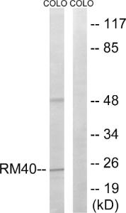 Western blot analysis of lysates from COLO cells using Anti-MRPL40 Antibody. The right hand lane represents a negative control, where the Antibody is blocked by the immunising peptide