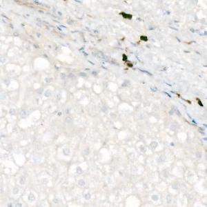 Immunohistochemistry analysis of paraffin-embedded human liver (negative control sample) using Anti-MUM1 Antibody [ARC58086] (A309925) at a dilution of 1:100/300/900 (40X lens). Perform high pressure antigen retrieval with 10 mM Tris/EDTA buffer pH 9.0 before commencing with IHC staining protocol