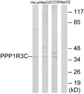 Antibody anti-PPP1R3C A100127-100 100 µg