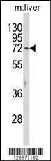 Anti-Hexosaminidase A. Rabbit Polyclonal Antibody (Biotin)