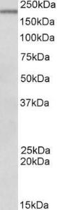 Anti-Dennd4c Antibody (A82741) (0.5µg/ml) staining of Mouse Spleen lysate (35µg protein in RIPA buffer). Primary incubation was 1 hour. Detected by chemiluminescence.