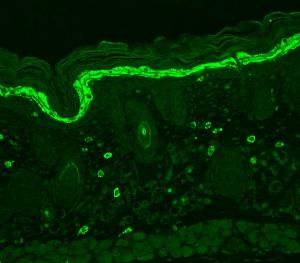 Immunohistochemistry analysis of mouse backskin, fixed in Bouin's fixative solution and paraffin-embedded