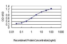 Anti-DFNB31 Mouse Monoclonal Antibody [clone: 1D9]