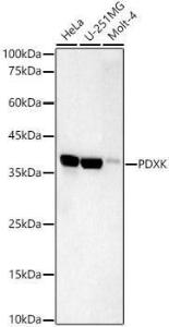 Western blot analysis of various lysates, using Anti-PDXK.1 Antibody [ARC59845] (A309927) at 1:1,000 dilution