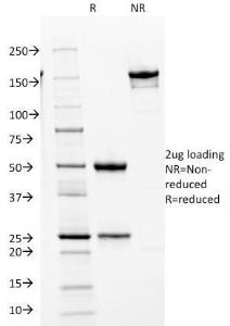 SDS-PAGE analysis of Anti-CDK2 Antibody [AN4.3] under non-reduced and reduced conditions; showing intact IgG and intact heavy and light chains, respectively. SDS-PAGE analysis confirms the integrity and purity of the antibody