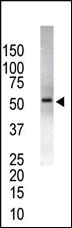 Anti-USP14 Rabbit Polyclonal Antibody