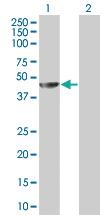 Anti-MAGEA4 Mouse Polyclonal Antibody