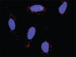 Anti-FAS + FASLG Antibody Pair