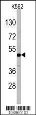 Anti-RGMB Rabbit Polyclonal Antibody (HRP (Horseradish Peroxidase))