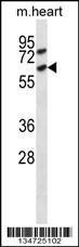 Anti-ACVR1C Rabbit Polyclonal Antibody (AP (Alkaline Phosphatase))