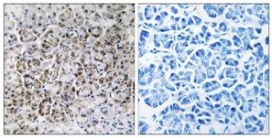 Immunohistochemical analysis of paraffin-embedded human pancreas tissue using Anti-MRPL40 Antibody. The right hand panel represents a negative control, where the Antibody was pre-incubated with the immunising peptide