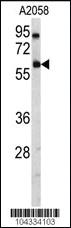 Anti-USP14 Rabbit Polyclonal Antibody