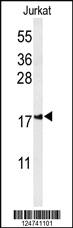 Anti-IMMP2L Rabbit Polyclonal Antibody [clone: 429CT16.3.1]