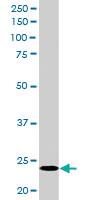 Anti-BCL2L11 Goat Polyclonal Antibody