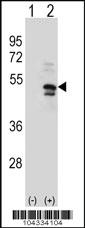 Anti-USP14 Rabbit Polyclonal Antibody