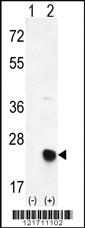 Anti-MSRB2 Rabbit Polyclonal Antibody