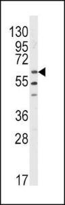 Anti-LYN Rabbit Polyclonal Antibody (FITC (Fluorescein))