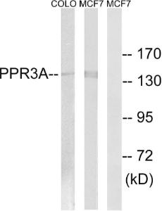 Western blot analysis of lysates from MCF-7 and COLO cells using Anti-PPP1R3A Antibody. The right hand lane represents a negative control, where the antibody is blocked by the immunising peptide