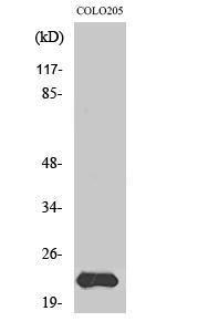 Western blot analysis of various cells using Anti-MRPL40 Antibody