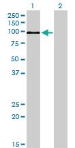 Anti-MAPK6 Mouse Monoclonal Antibody [clone: 1G6]