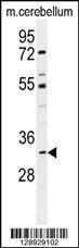 Anti-ALKBH6 Rabbit Polyclonal Antibody (AP (Alkaline Phosphatase))