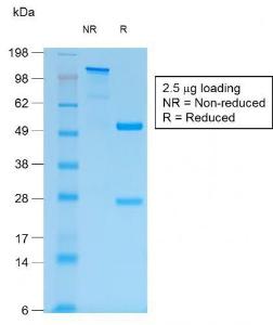 SDS-PAGE analysis of Anti-MUC1 Antibody [MUC1/1887R] under non-reduced and reduced conditions; showing intact IgG and intact heavy and light chains, respectively. SDS-PAGE analysis confirms the integrity and purity of the antibody