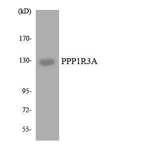 Western blot analysis of the lysates from HT 29 cells using Anti-PPP1R3A Antibody