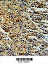 Anti-PHTNS Rabbit Polyclonal Antibody