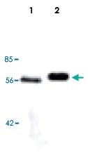 Anti-LPL Mouse Monoclonal Antibody [clone: LPL.A4]