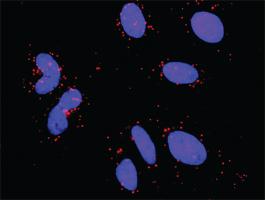 Anti-MAPK3 + RPS6KA3 Antibody Pair