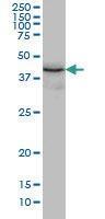 Anti-Thioredoxin Domain Containing 4 Mouse Monoclonal Antibody [clone: 3C7]