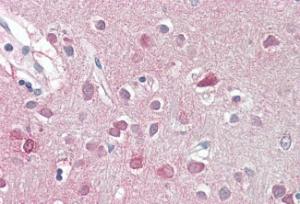 Anti-ORC3L Antibody (A82743) (3.75 µg/ml) staining of paraffin embedded Human Cortex. Steamed antigen retrieval with citrate buffer pH 6, AP-staining